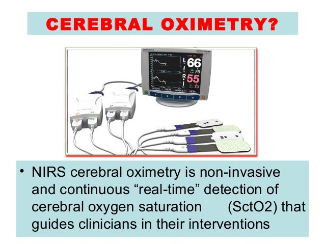 Brain Protection in Cardiac Surgery